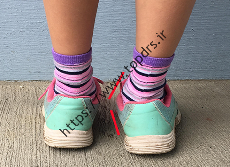 بهترین کفش برای کودکان با کف پای صاف: