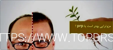 آر اف بهتر است یا هایفو