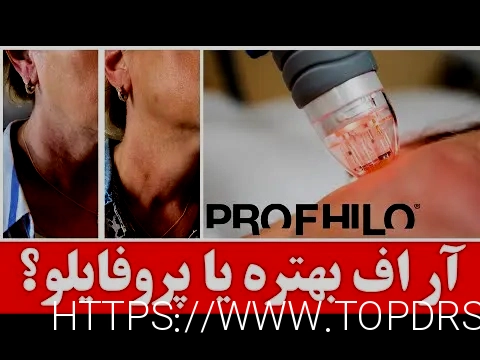 آر اف بهتر است یا هایفو